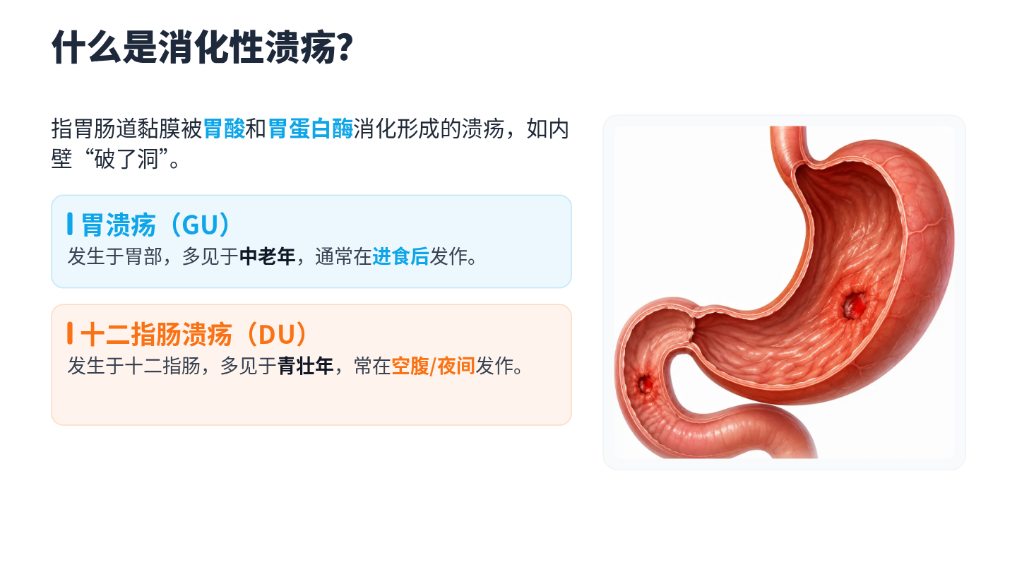 消化性溃疡健康宣教 第4页