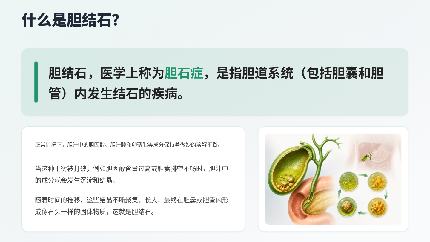 胆结石健康宣教 第3页