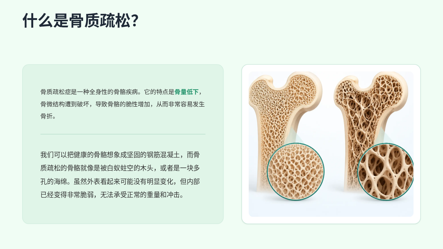 骨质疏松健康宣教 第3页