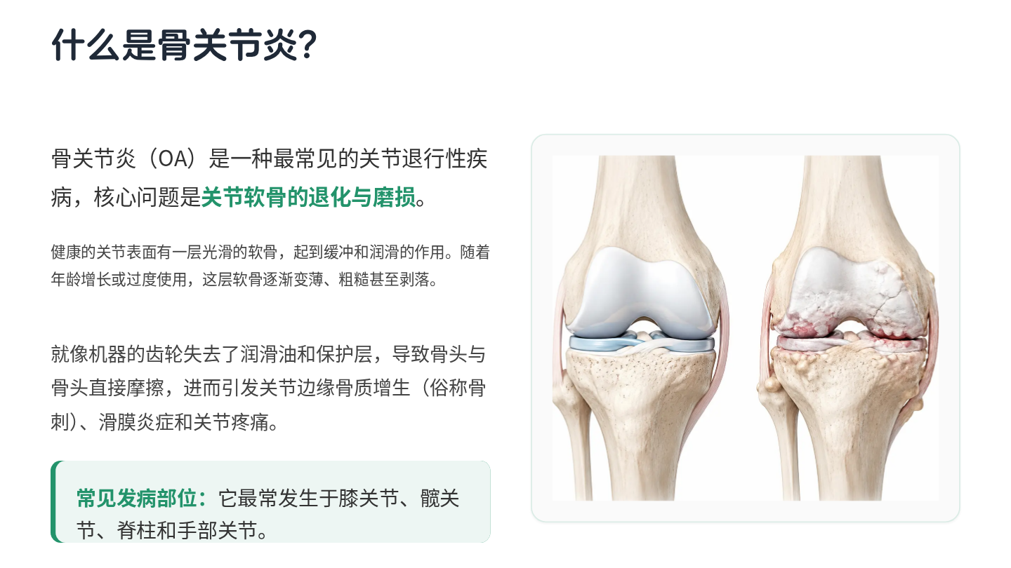 骨关节炎健康宣教 第3页