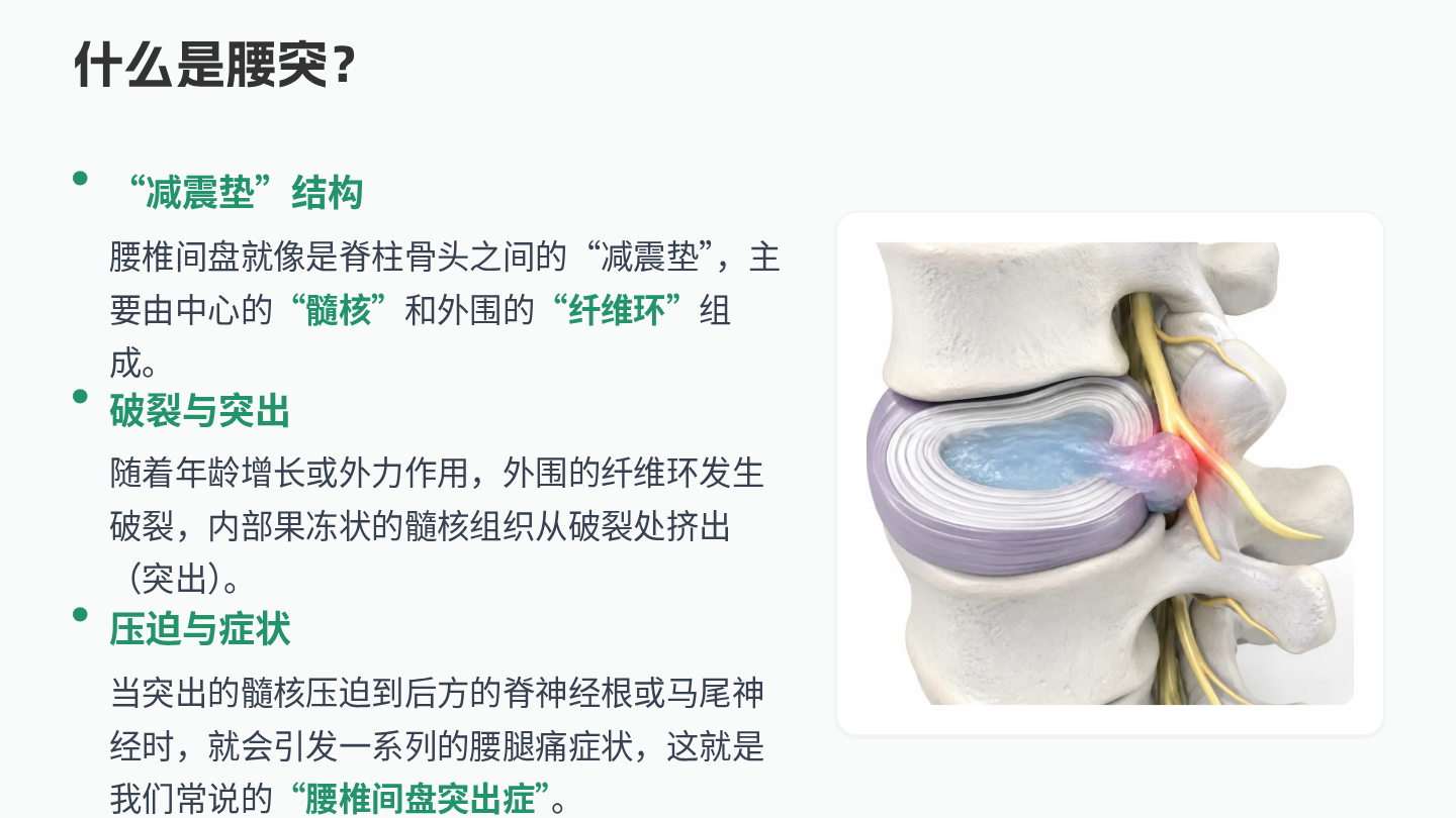 腰椎间盘突出健康宣教 第4页