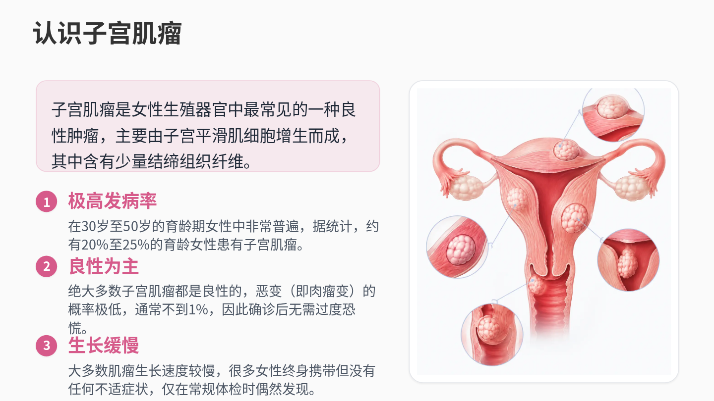 子宫肌瘤健康宣教 第3页